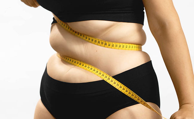 Fat Transfer